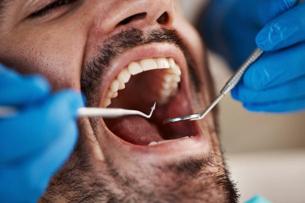 Best Emergency Dentist for Knocked-Out Tooth in Glencoe, AL